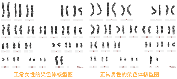 正常男性和女性的染色体核型图