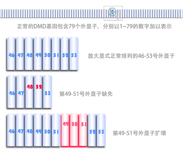 DMD基因突变（外显子缺失和外显子扩增）示意图