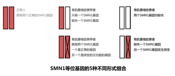 脊肌萎缩症基因突变的几种不同情况