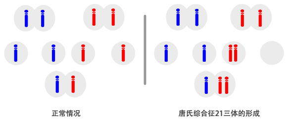 唐氏综合征发生原理